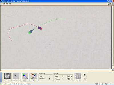 Image analysis software VideoTesT for sperm analysis