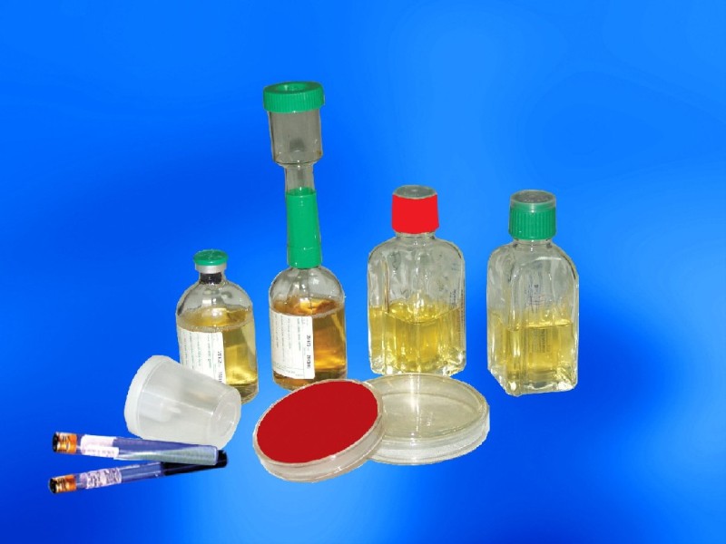 CDRICH agar, stain, culturing bottle