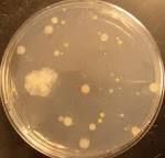 R2A Agar