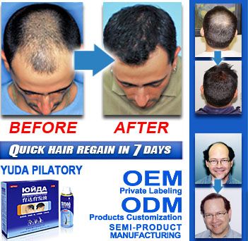 Yuda Herbal Extract Hair Loss Treatment Product