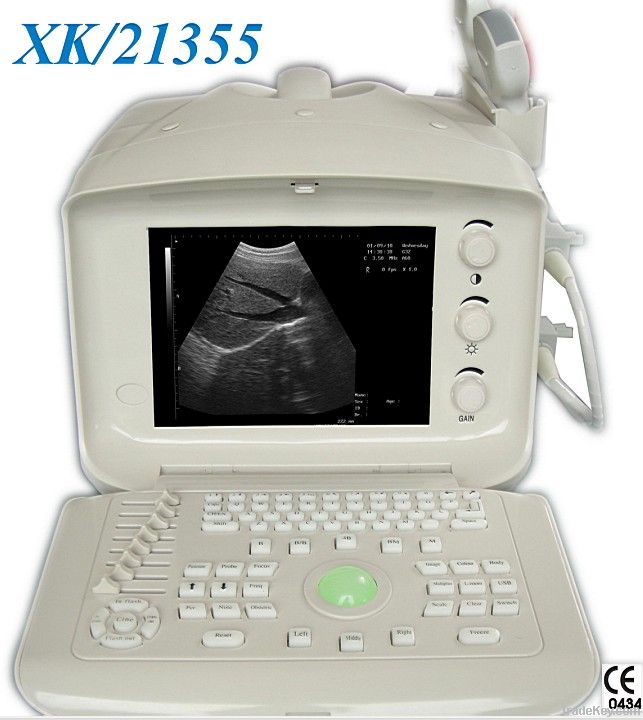 Portable Digital Ultrasound Scanner