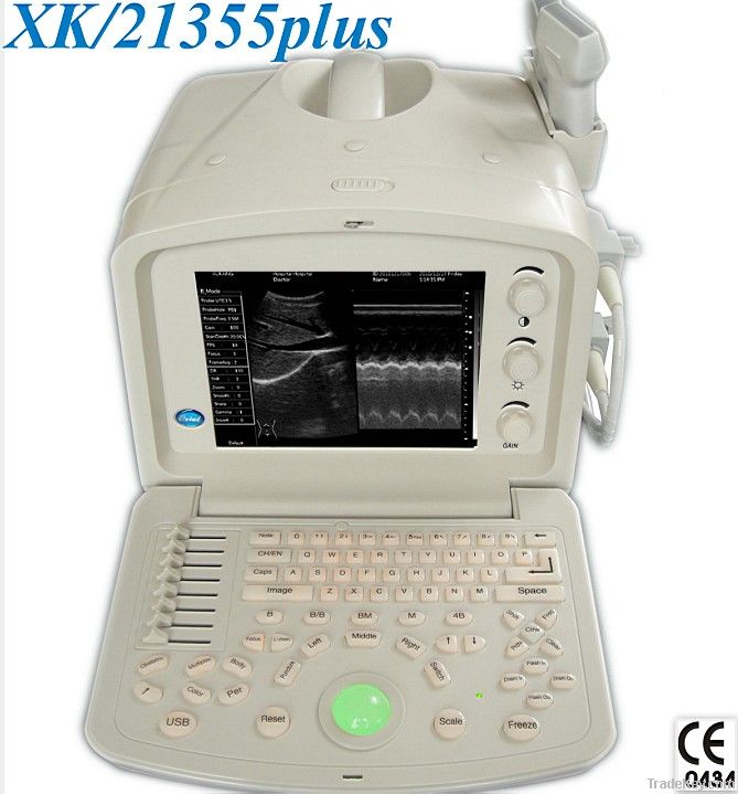 Full Digital Portable Ultrasound Scanner