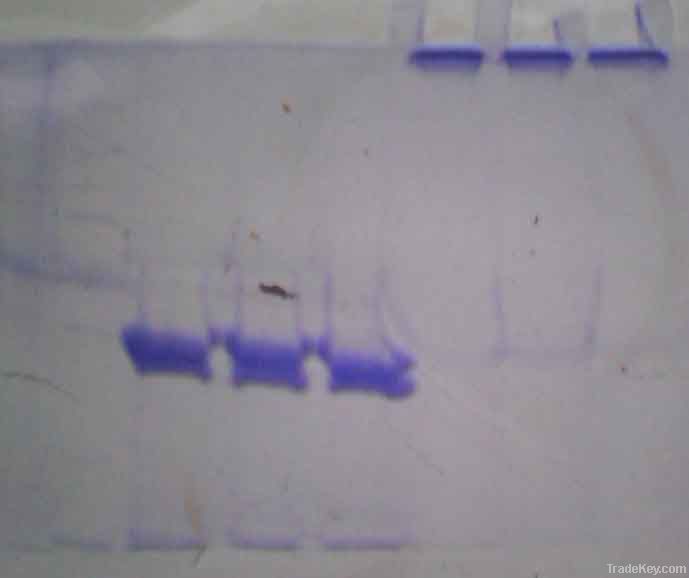 Recombinant lysostaphin