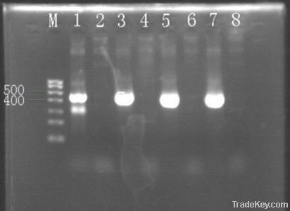 Recombinant pfu DNA polymerase