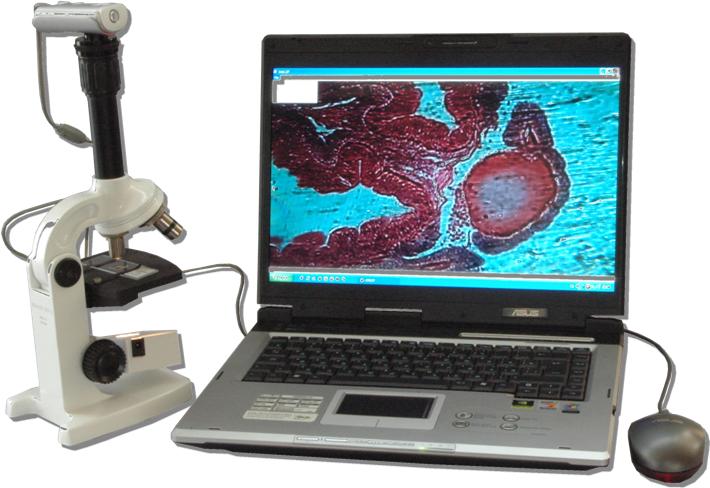 Illuminated digital microscope Younnat 2P3 Video 80x-800x