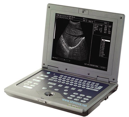 Laptop Ultrasound Scanners