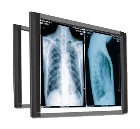 x-ray film viewer