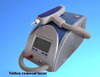 New portable tattoo removal laser