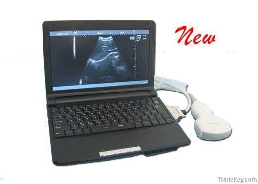 3000 Laptop Full Digital Ultrasound