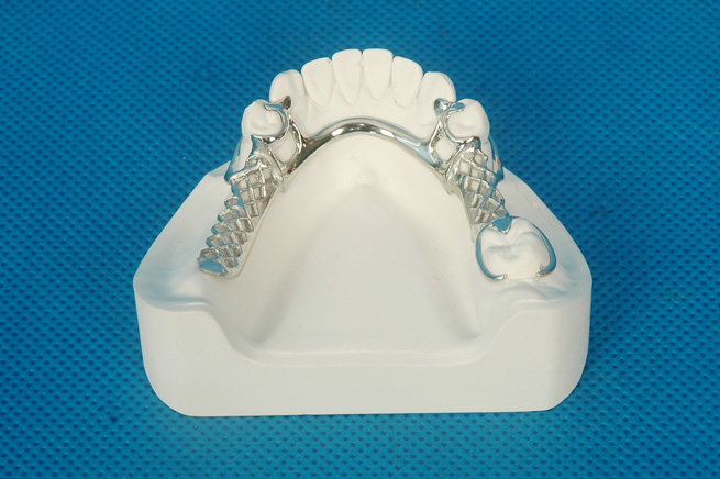 Dental Metal Framework/Partial Denture