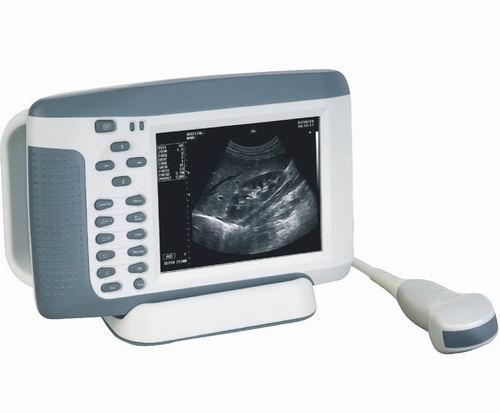 Palm ultrasound scanner