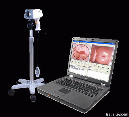 Digital Colposcope Imaging system