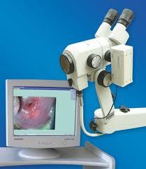 Colposcope C140: