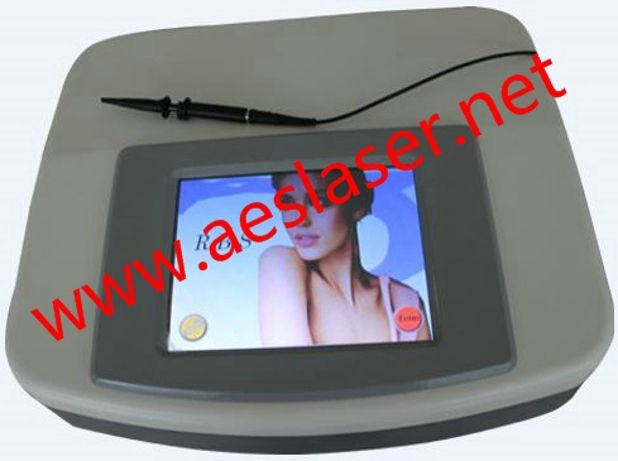 Fractional RF for Vascular and Spider Vein Removal