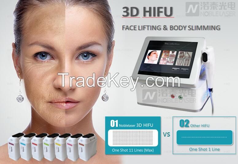 3D HIFU Face Lifting Body Slimming