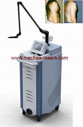 Nd Yag Long Pulse Laser Hair Removal Beauty Equipment