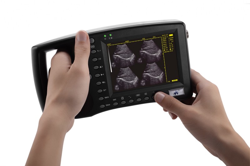 palmsize B/W medical ultrasound scanner