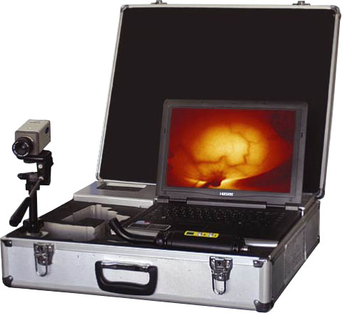 infrared galactophore diagnosis system (portable, solar battery)