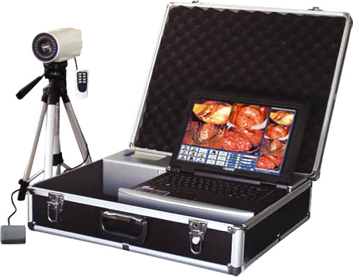 electronic colposcope (portable)