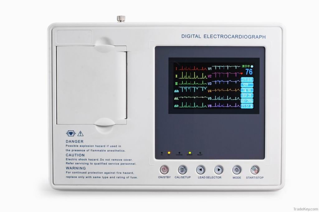 three channel color ECG