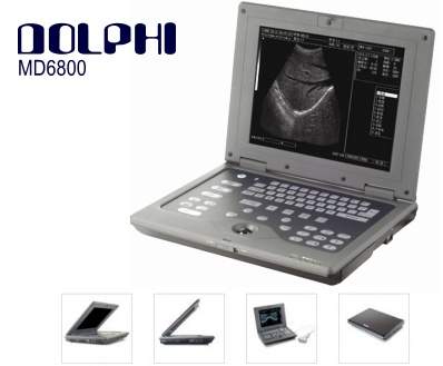 Notebook Ultrasound Scanner