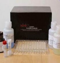 Human Papillomavirus IgG, HPV-IgG ELISA Kit