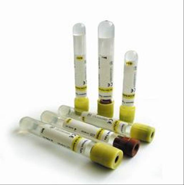 Vacuum blood collection tube --- Gel & clot activator tube
