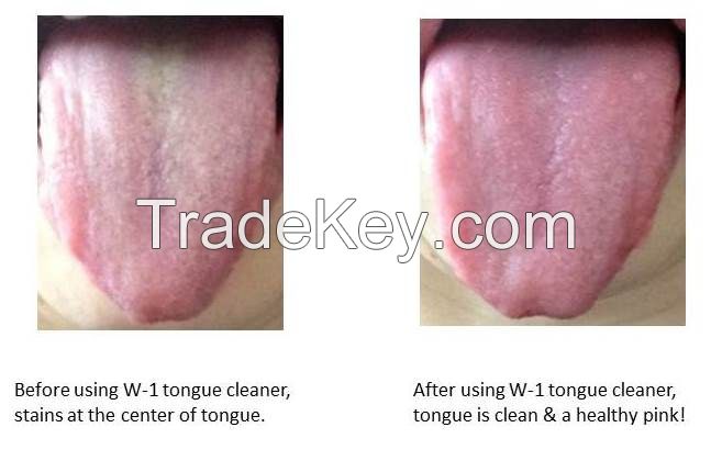 W-1 Tongue Cleaner