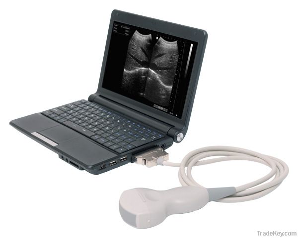 Laptop Ultrasound Scanner