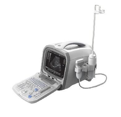 Digital Ultrasound Diagnostic System