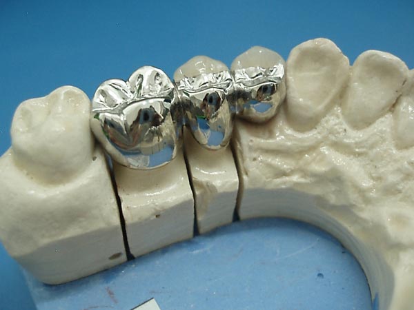 Dental full metal crown