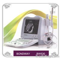 Digital Ultrasound Scanner (BW530)