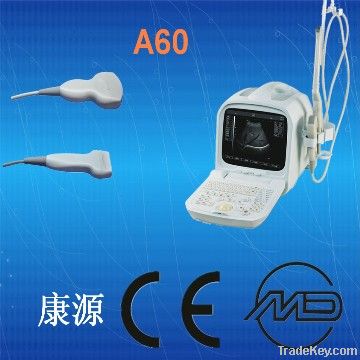 portable ultrasound system