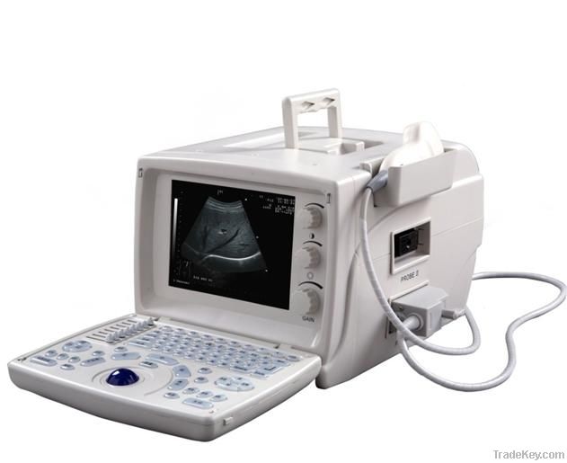 B-Mode Portable Ultrasound scanner