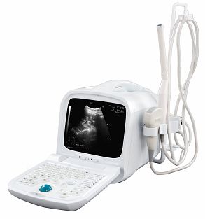 B Mode Ultrasound Scanner S990