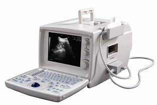 Digital Doppler Ultrasound Scanner S660