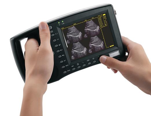 Palmtop Digital Ultrasound Scanner S550