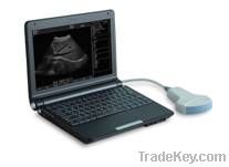 B ultrasound