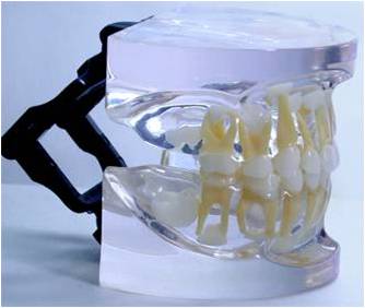 Transparent Alternating Model of Primary and Permanent Teeth