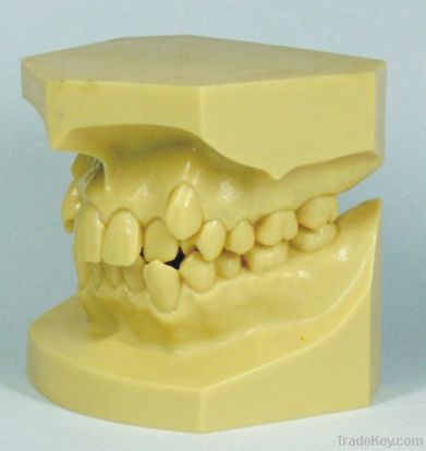 Resin malocclusion jaw model/Resin Malocclusion Model/Orthodontic Mode