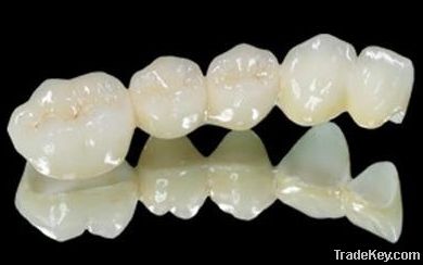 Zirconia Crown