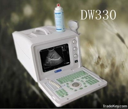 DW330 portable full digital Ultrasound scanner