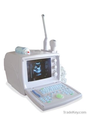 DW360 B mode portable full digital ultrasound scanner