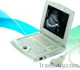 Digital Laptop Ultrasound Scanner (KX5000)