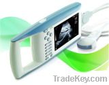 Digital Palm Ultrasound Scanner (KX5100)