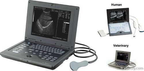 Digital Notebook Ultrasound Scanner