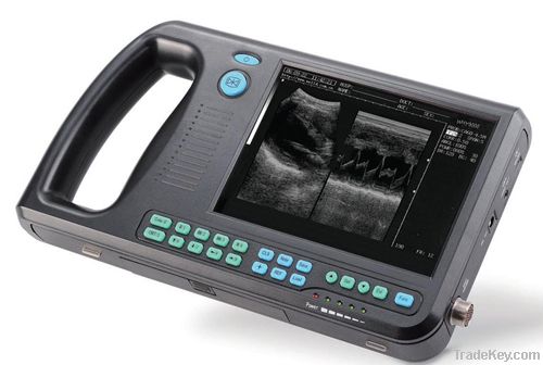 Palmtop Digital Ultrasound Scanner