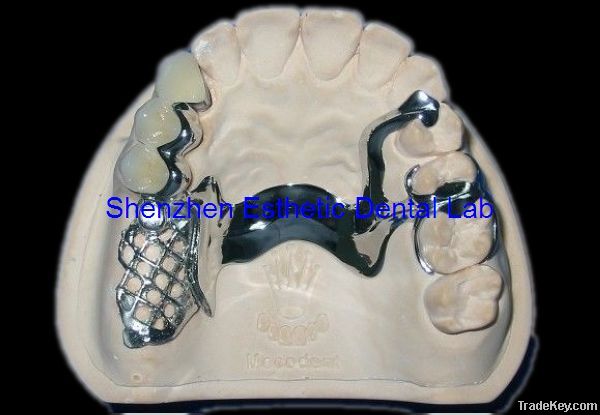 Dental metal partial framework