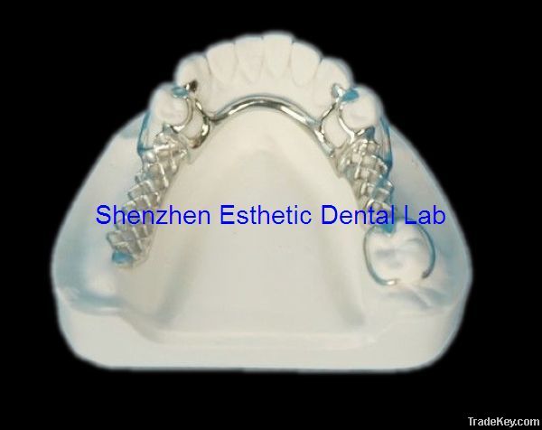 Dental metal partial framework