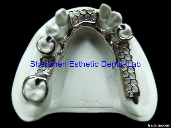 Dental metal partial framework
